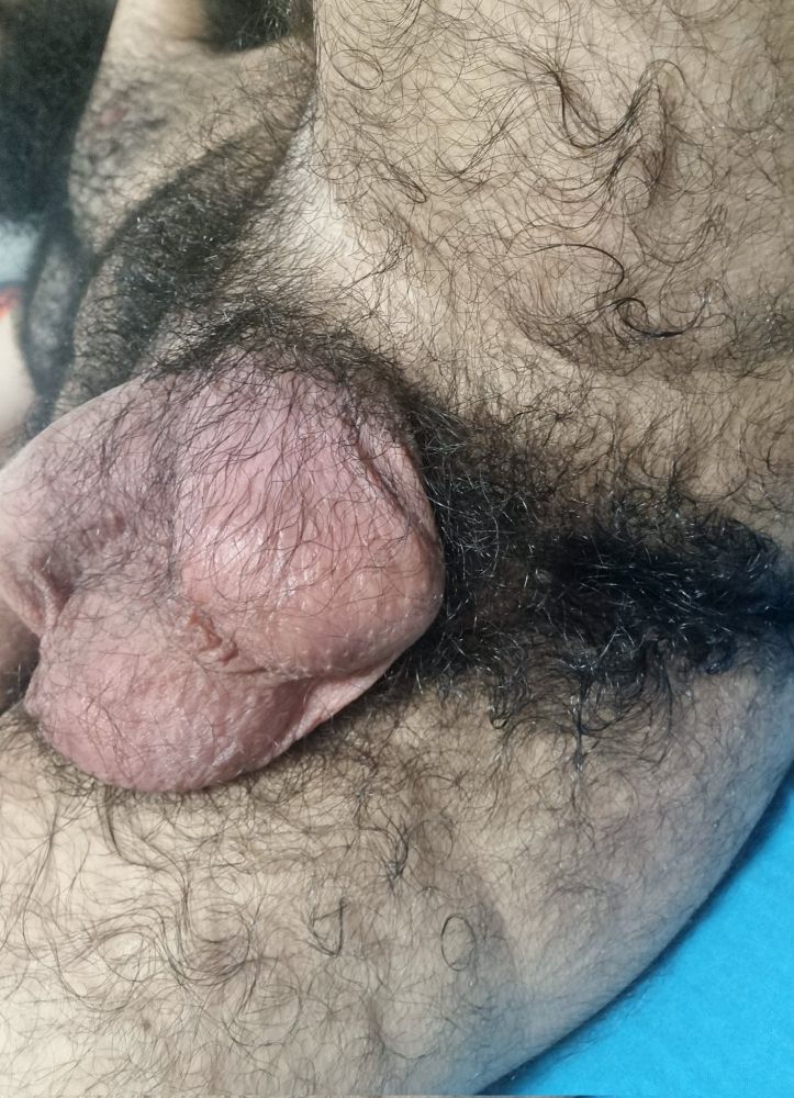 A hairy guy showing his hairy hole