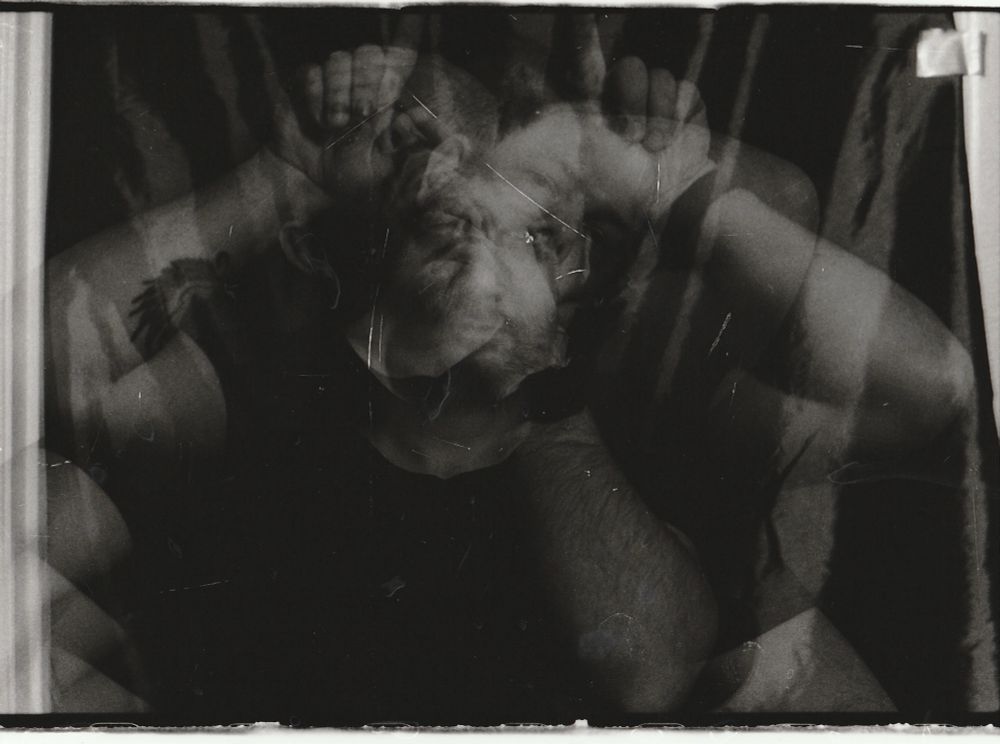 Black and white photo of a person with heavy distortion showing multiple arms and scattered facial features