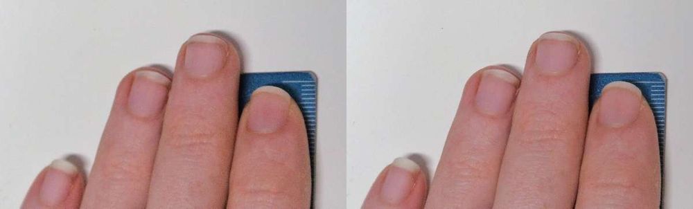 Two photos of my left hand fingertips on top of a metric ruler, one where the ring finger is about 5mm longer than the index, another where it's about 3mm longer. Apparently this is the statistical difference in high and low androgen prenatal conditions