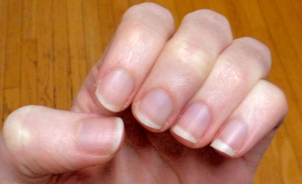 The fingertips of a left hand, curled inward so the nails can be more of the picture