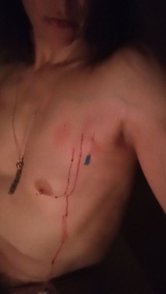 In this shot, I have taken all but one of the the needles out. None have the punctures have done more than produce a bead of blood, but this one surprises and delights me by bleeding dramatically from both ends of the puncture. I wasn't even looking, was turning to dispose of the needle, when I felt the trickles down my side and along the curve of my breast, and a drop falling from my breast to my thigh. Here you can see that I have tasted the blood--there is a smear of it on my lips.