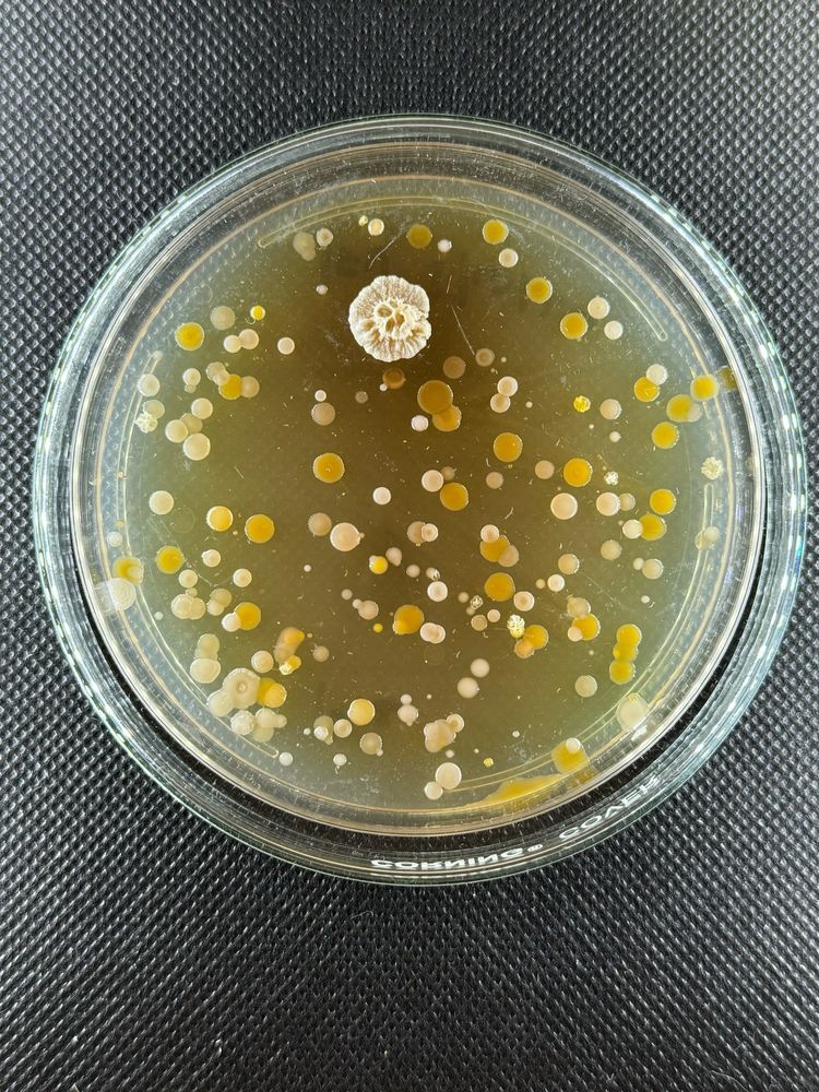 Clear, glareless photo of an agar Petri dish with many microbial colonies.  