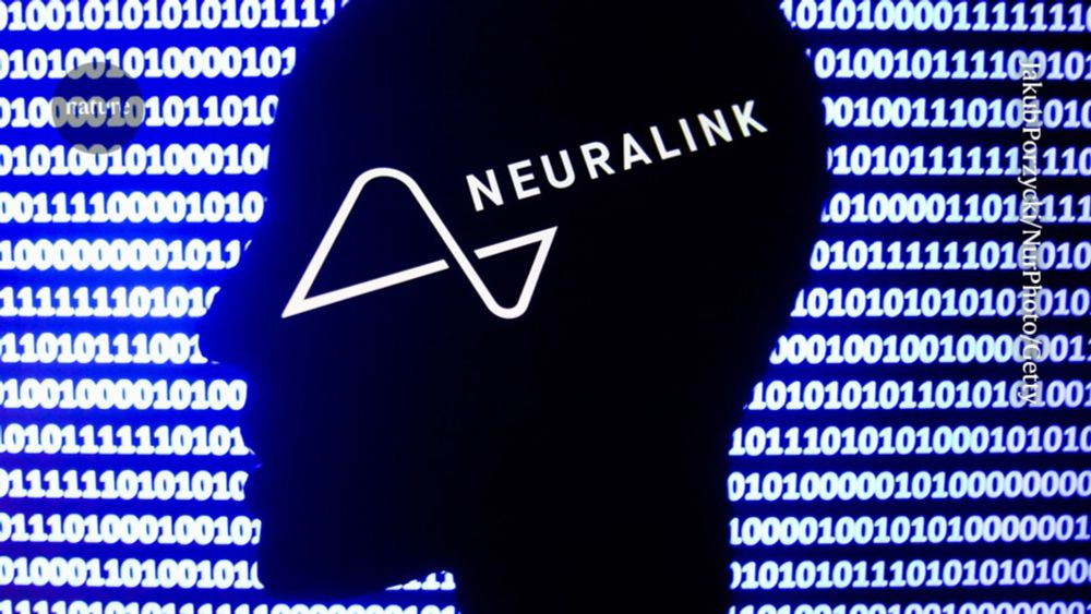 Second brain implant by Elon Musk’s Neuralink: will it fare better than the first?