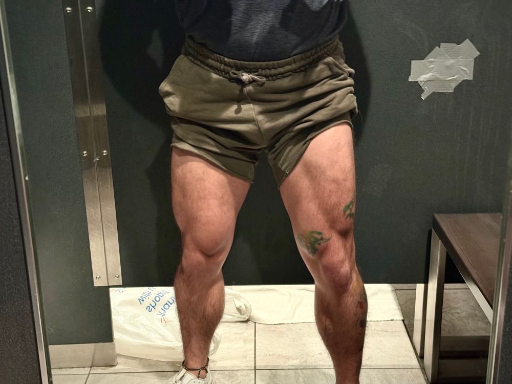 A picture of a man from the waist down wearing green shorts pulled up to show muscular legs