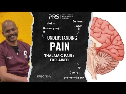 What is Thalamic pain? |How can it be diagnosed? |Thalamic Pain syndrome |Understanding pain: Ep.06