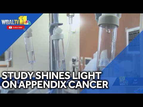 Study shines light on misdiagnosed appendix cancer