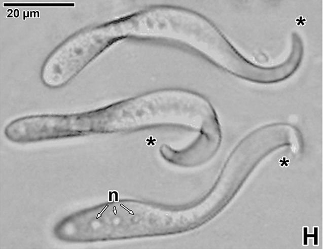 Composite micrograph showing the sequence of movement of a single detached Siedleckia nematoides parasite, shown as three separate individuals.
From Fig. 1H of the paper: Valigurova, A., Vaškovicová, N., Diakin, A., Paskerova, G. G., Simdyanov, T. G., & Kováčiková, M. (2017). Motility in blastogregarines (Apicomplexa): Native and drug-induced organisation of Siedleckia nematoides cytoskeletal elements. PLoS One, 12(6), e0179709.
https://journals.plos.org/plosone/article?id=10.1371/journal.pone.0179709