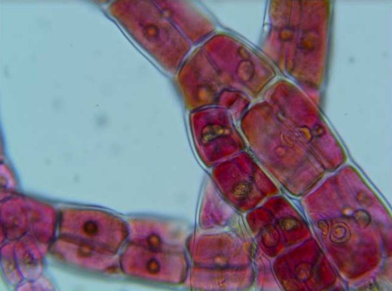a photomicrograph of ‘Brominata’ tetrasporophyte material growing in the laboratory, showing the unusually large gland cells (the orange/black dots). The gland cells are what contains the active ingredient (bromoform). Large gland cells indicate an unusually high concentration of bromoform