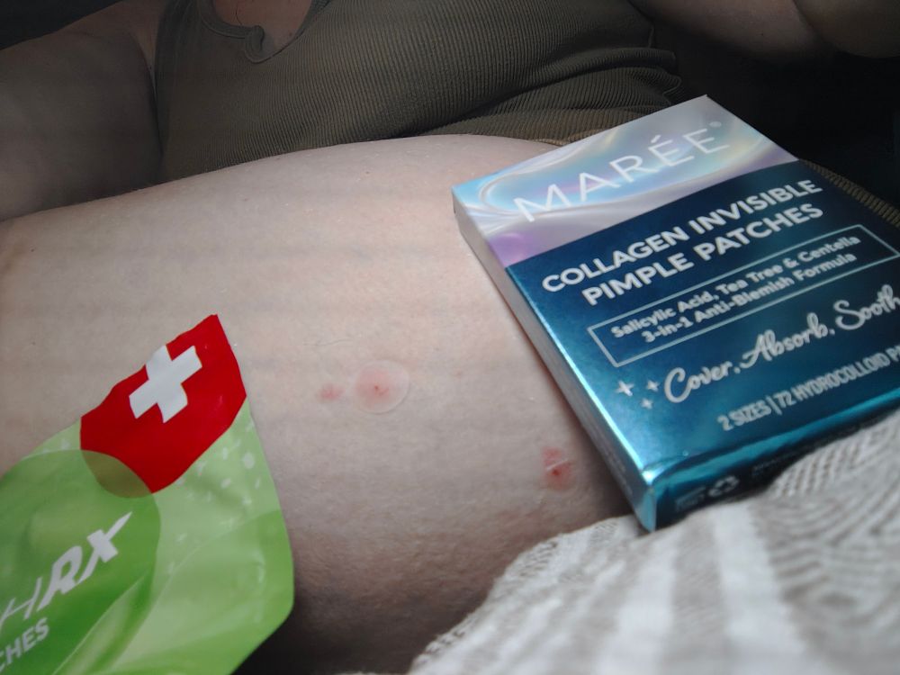 Same two bug bites with their respective patches.

Left bite: PatchRX - Hydrocolloid, aloe vera, witch hazel

Right bite: Marée Collagen Invisible Pimple Patches - Salicylic acid, hydrolyzed collage, tea tree oil, centella
