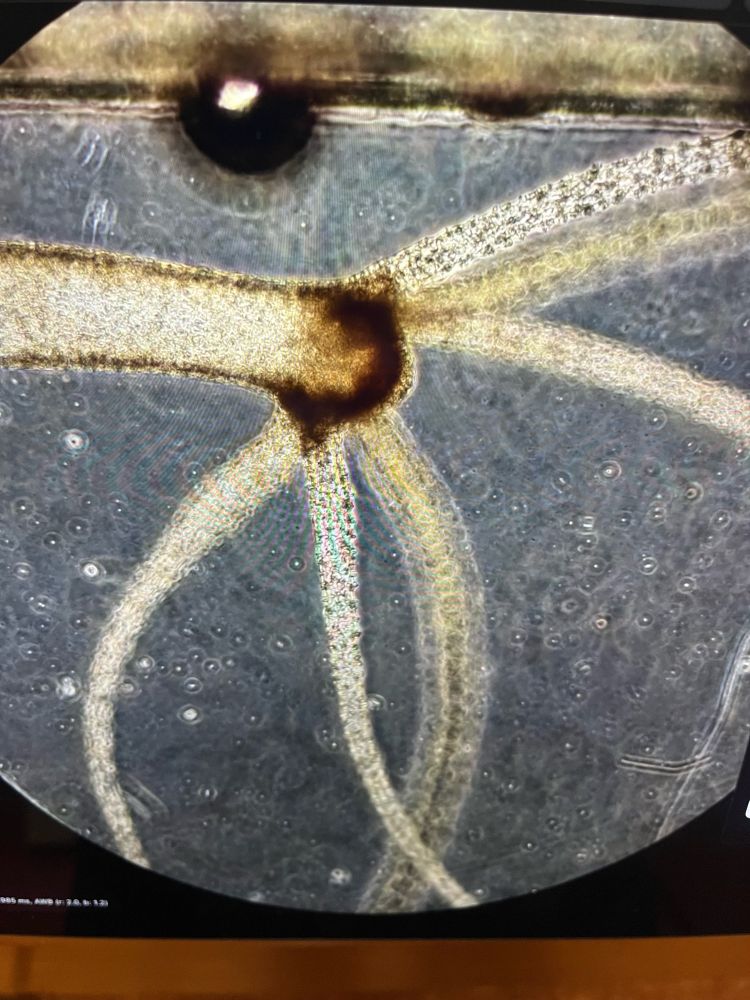 Close up of a Hydra (head in particular)
