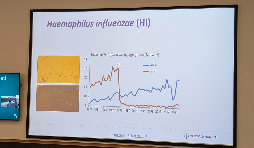 Graph showing effect of introduction of vaccination against Haemophilus influenzae in Norway in 1992 on childhood disease (going down).