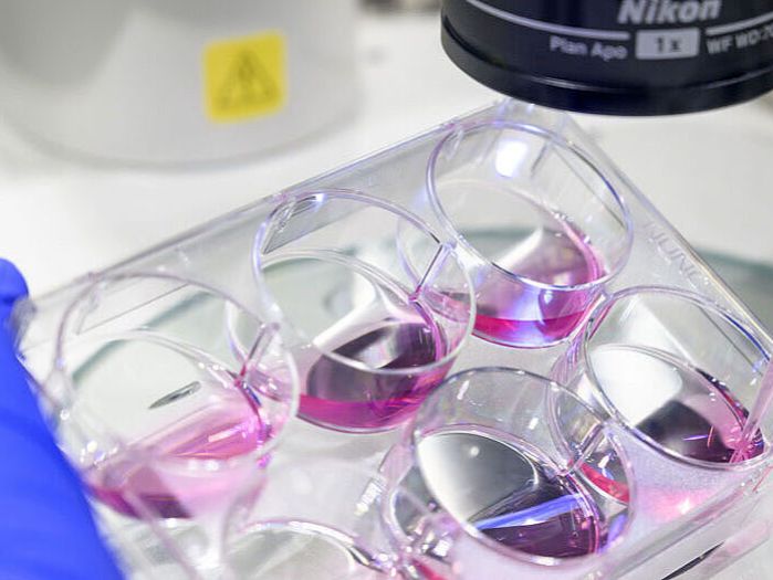 Symbolic image og lab work. Source: DZNE / Frommann