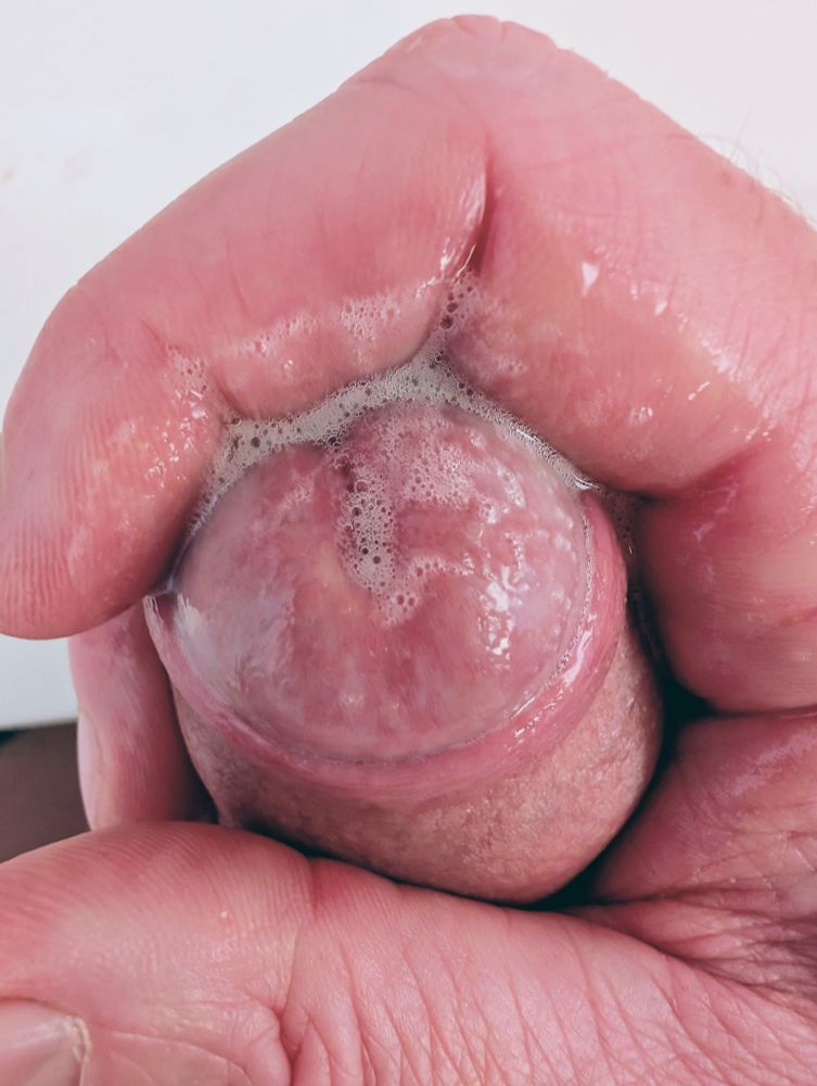 A well masturbated penis is showing a huge amount of gloopy precum, just starting to froth up under the up and down action of the man's hand