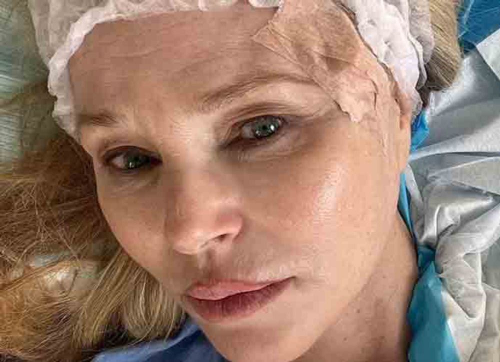 Christie Brinkley Says She Accidentally Discovered Skin Cancer On Her Face - uInterview