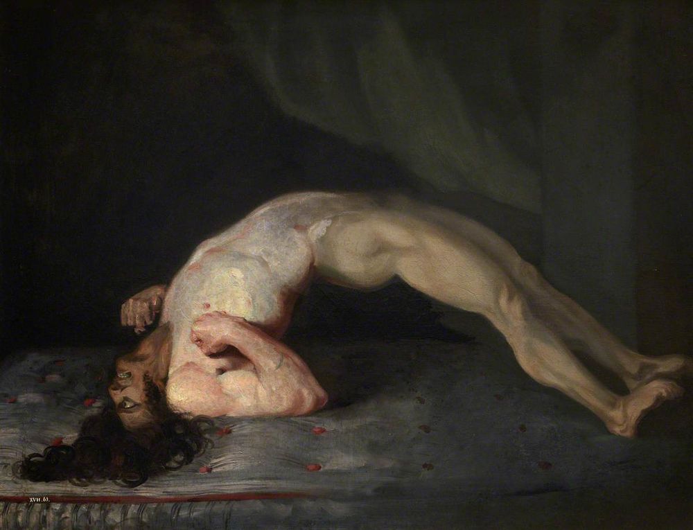 Painting showing opisthotonos in a patient suffering from tetanus. The naked man is experiencing full body spasms.