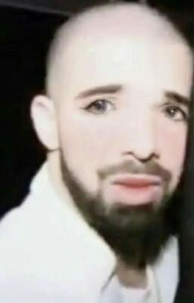 an edited image of bald drake