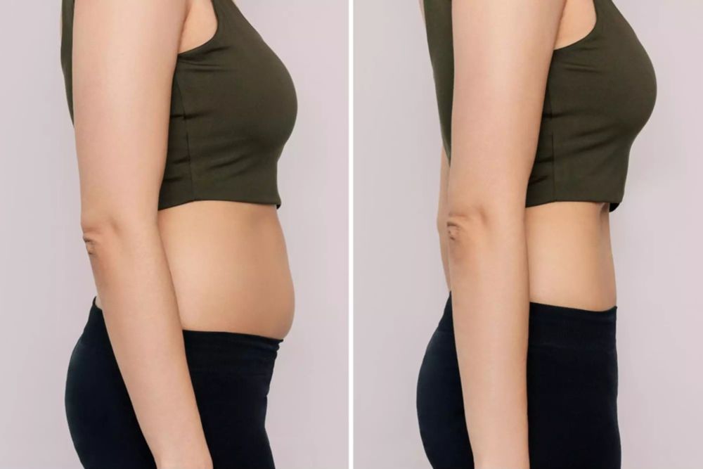 What is the Skinny Shot? - Slimming Solutions Med Spa