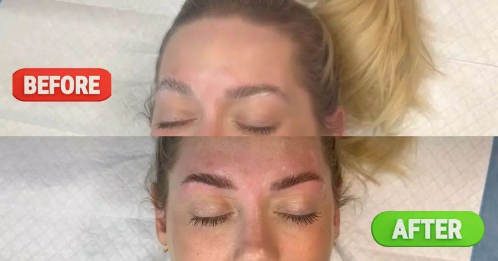 Eyebrow Lamination: Everything You Need to Know 2024