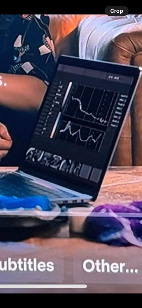 Electronic fetal monitoring strip showing uterine tachysystole and a prolonged fetal heart rate deceleration with minimal variability 