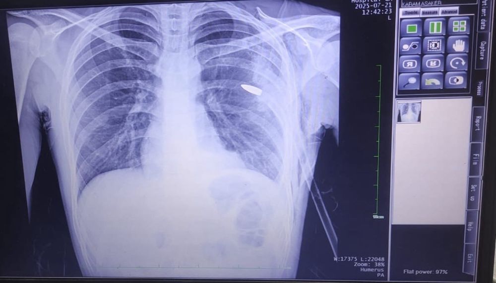 Karam's x-ray.