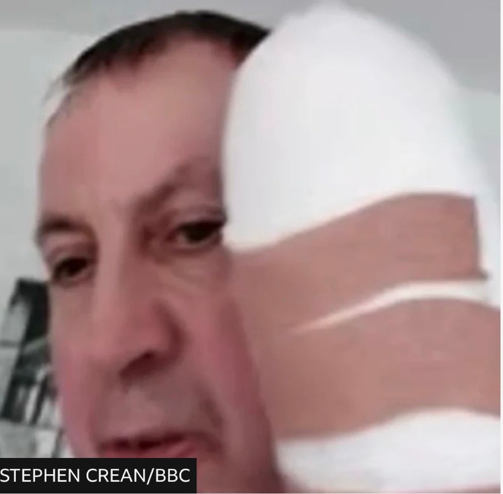 BBC’s Lucy Manning: ‘Pictured: Hero passenger Stephen Crean with heavily bandaged hand who confronted train attacker. Said there was a tussle and “he’s gone for me.” He wanted to make sure passengers could lock themselves in buffet car. Was sliced in head and hand.’
