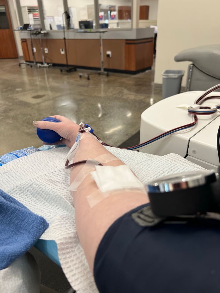 At the blood donation clinic, POV photo of an arm with all necessary holes, lines, and apparatuses to donate platelets. 