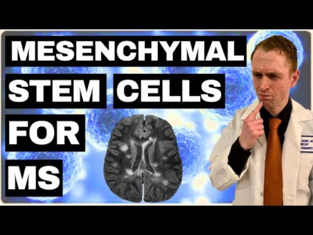 Mesenchymal Stem Cells for MS Explained by Neurologist