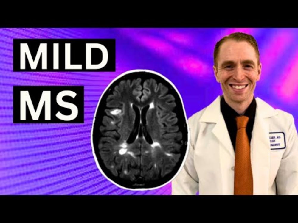 Mild Multiple Sclerosis Is Linked to These 10 Things
