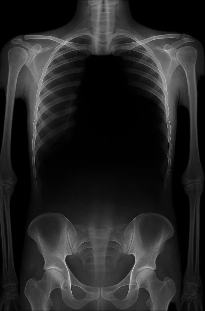 Comment image