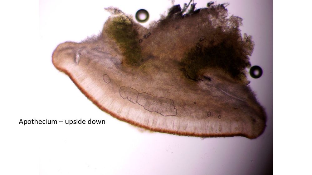 Section of apothecium