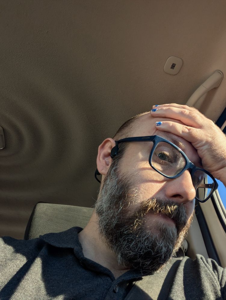 A picture of me in the car. My hand is on my forehead. Slightly longer hair can be seen on the back and sides of my shaved head. My fingernails are also a bit too long.