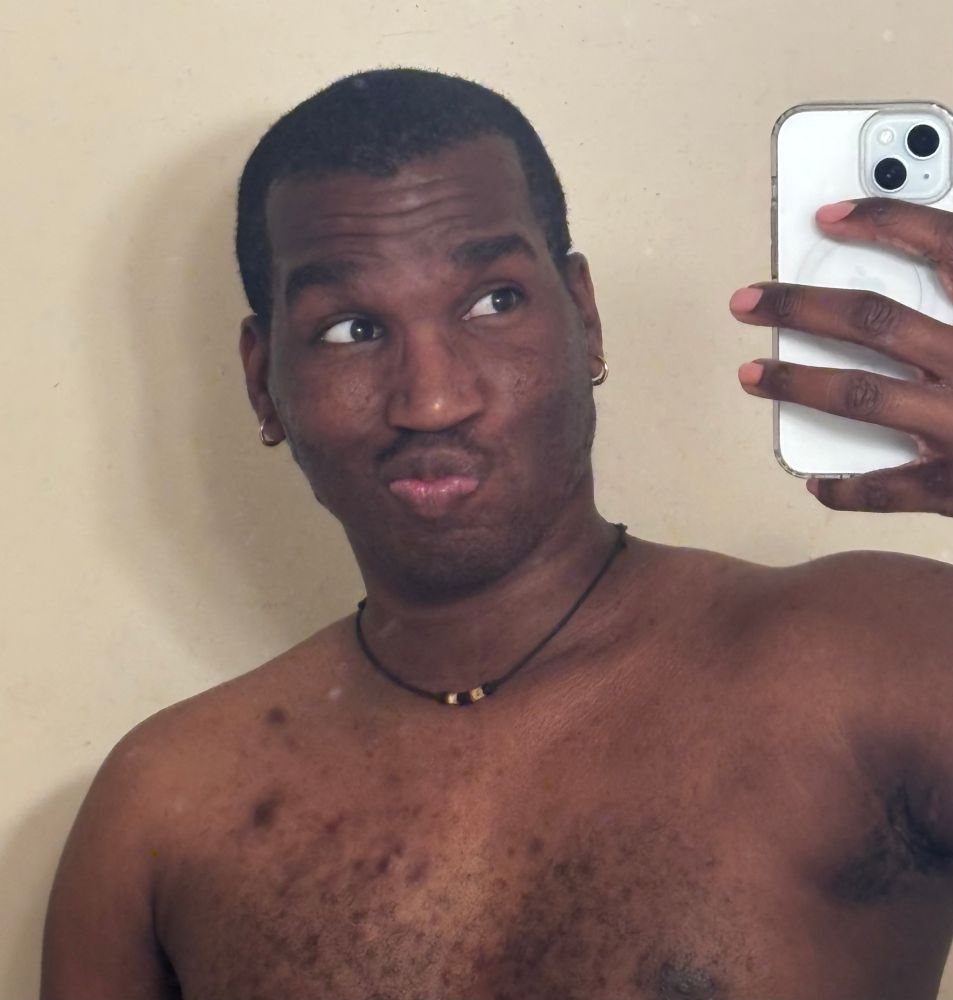 4j5 in a shirtless mirror selfie with a very old sharktooth necklace and holding up their light blue phone 