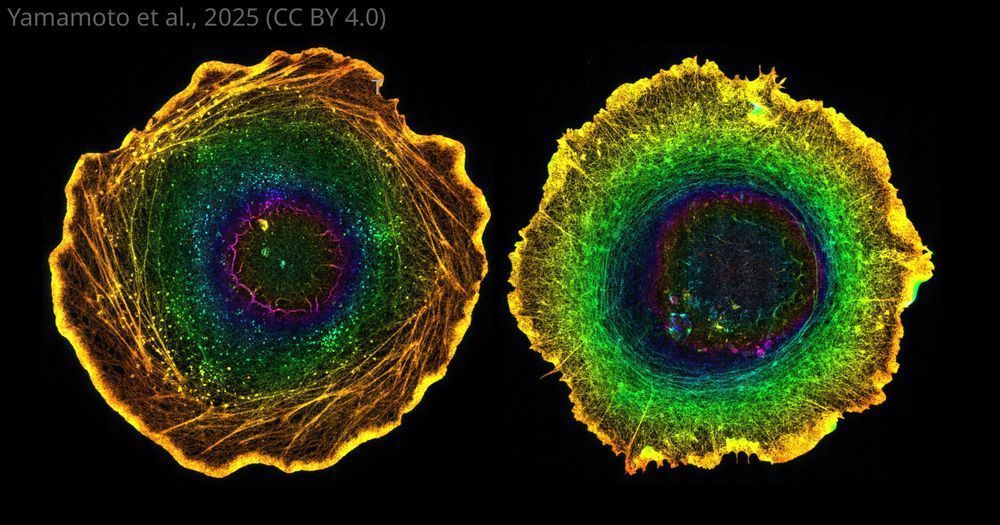 Rainbow imaged epithelial cells showing actomyosin forming spiral like structures in one
