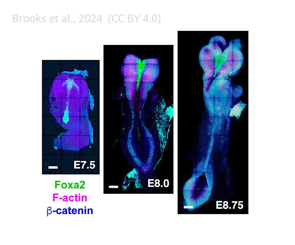  Images of mouse embryos spanning the stages of cranial neural tube closure