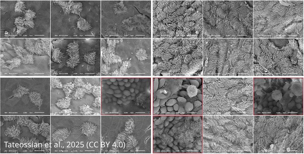 Scanning electron microscopy images from the middle ear of mice showing cilia
