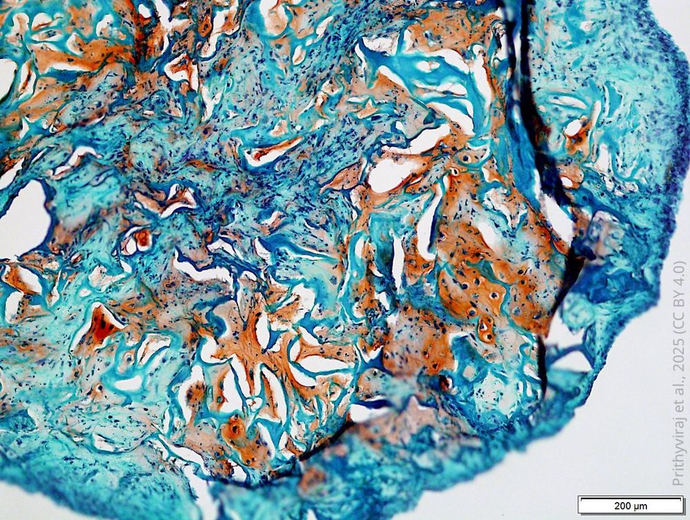 orange and cyan microscopy image of cartilage tissues