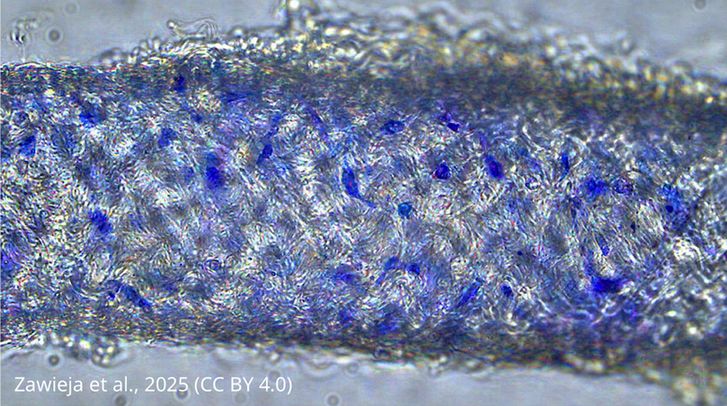 Methylene blue staining of isolated mouse IALVs
