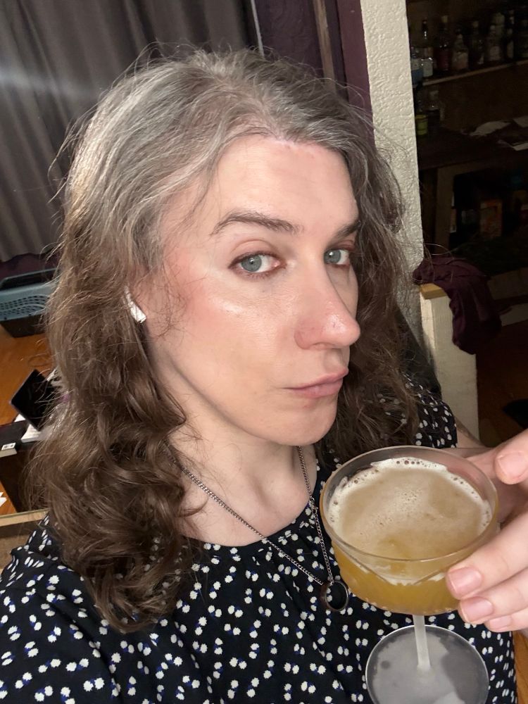 Margaret now after two rounds of face cutting and another two years of hrt