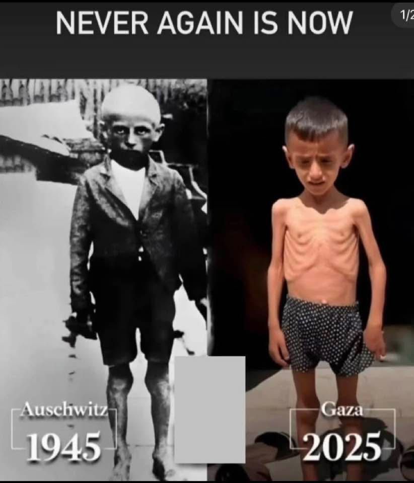 Headline: NEVER AGAIN IS NOW

Below that, 2 photos, side by side. One is in black and white and shows an emaciated child with the caption "Auschwitz 1945". The other is in colour and shows an emaciated child with the caption "Gaza 2025".