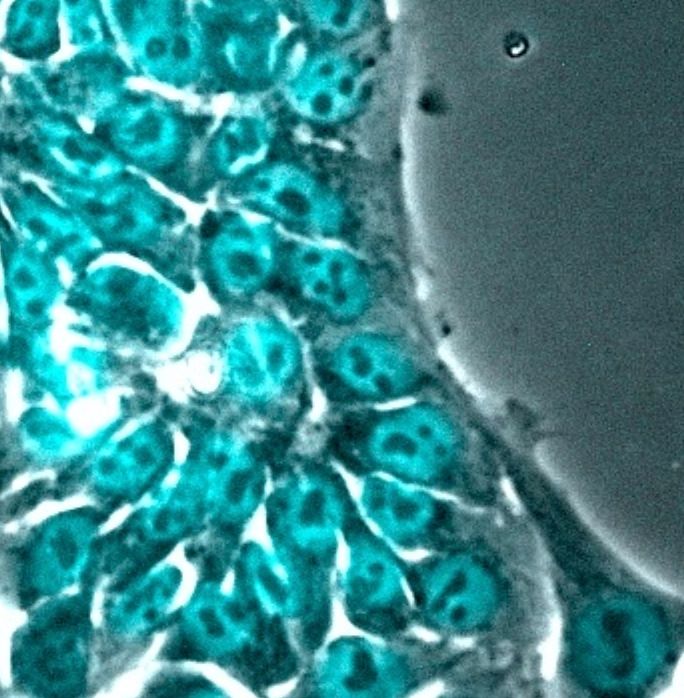 Immunocytochemistry micrograph showing cells appearing to make little faces. Some are aghast and some are just chilling with little sunglasses.