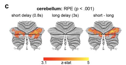 figure showing cerebellar RPE responses