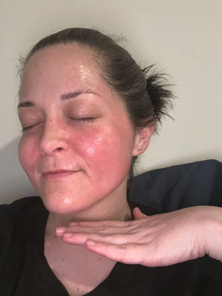 Selfie of me post-shower and PM skincare; my hair is tied back, eyes are closed, hand under my face framing the image of my red, irritated skin.