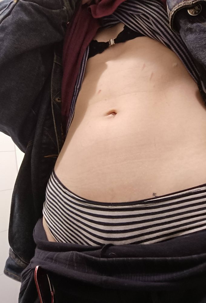 stripey black and white underwear and a matching top. pulled up to show belly and scratches. black lace bra is showing slightly and pulled down pants and jean jacket