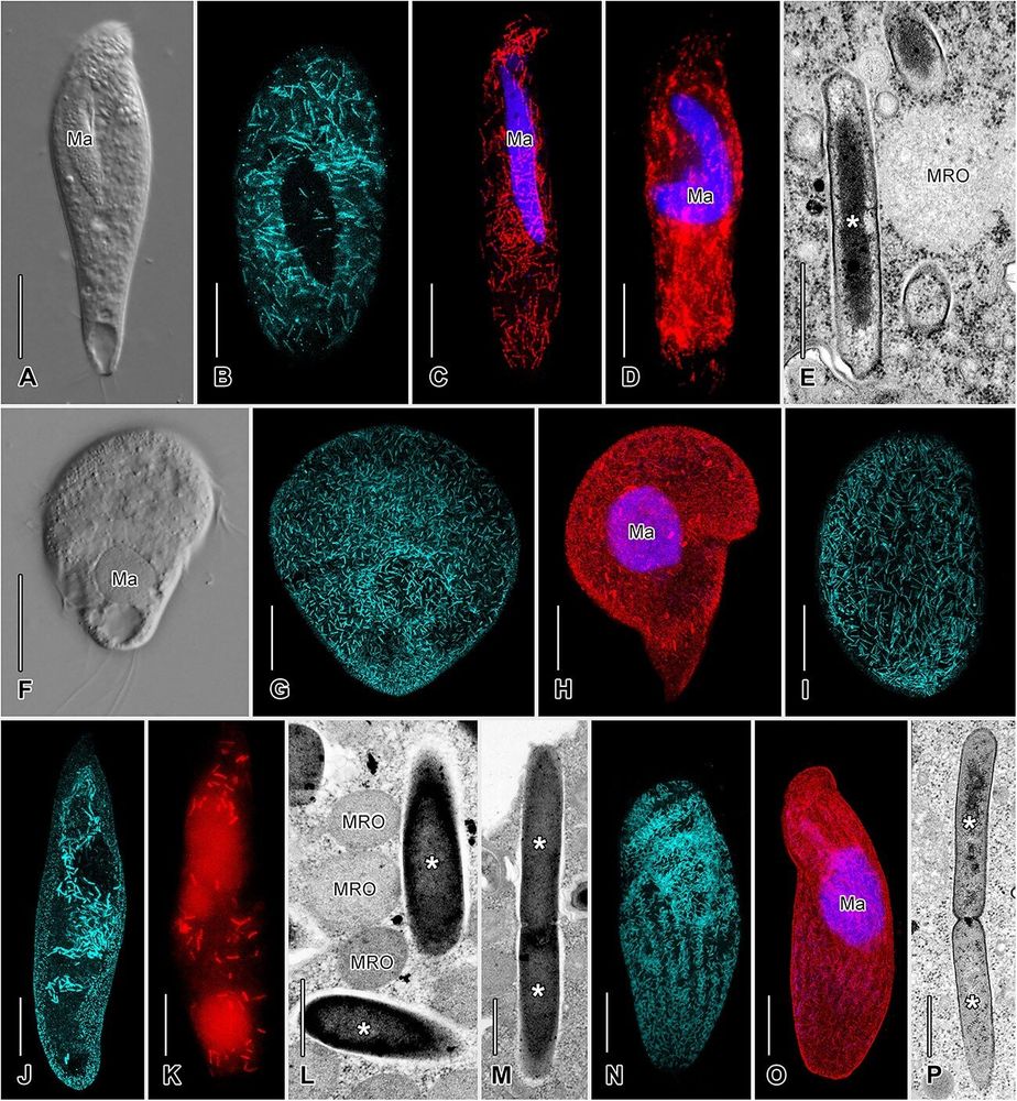 electron and fluorescence microscopy pictures of complex microbial cells 