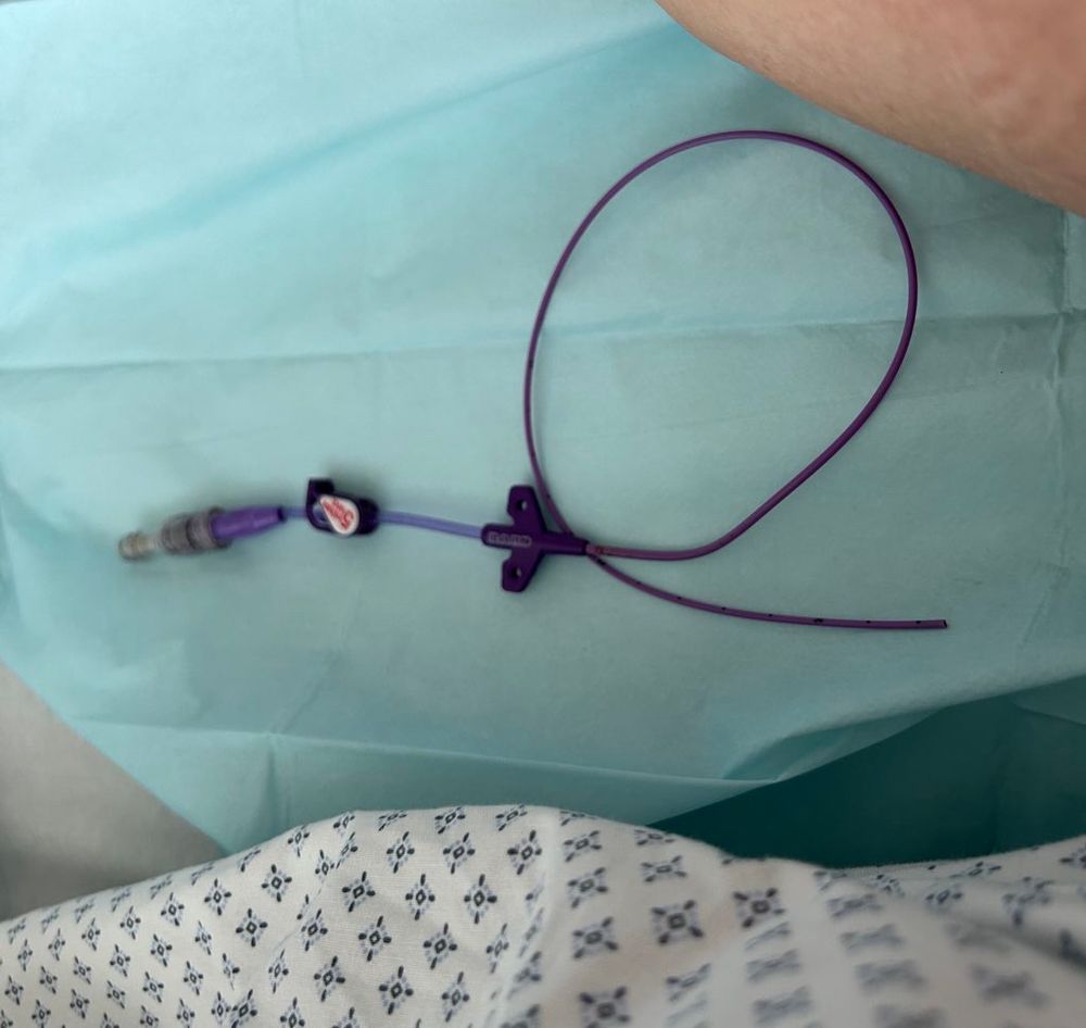 A purple catheter [peripherally inserted central catheter or PICC line] on a sterile green sheet.