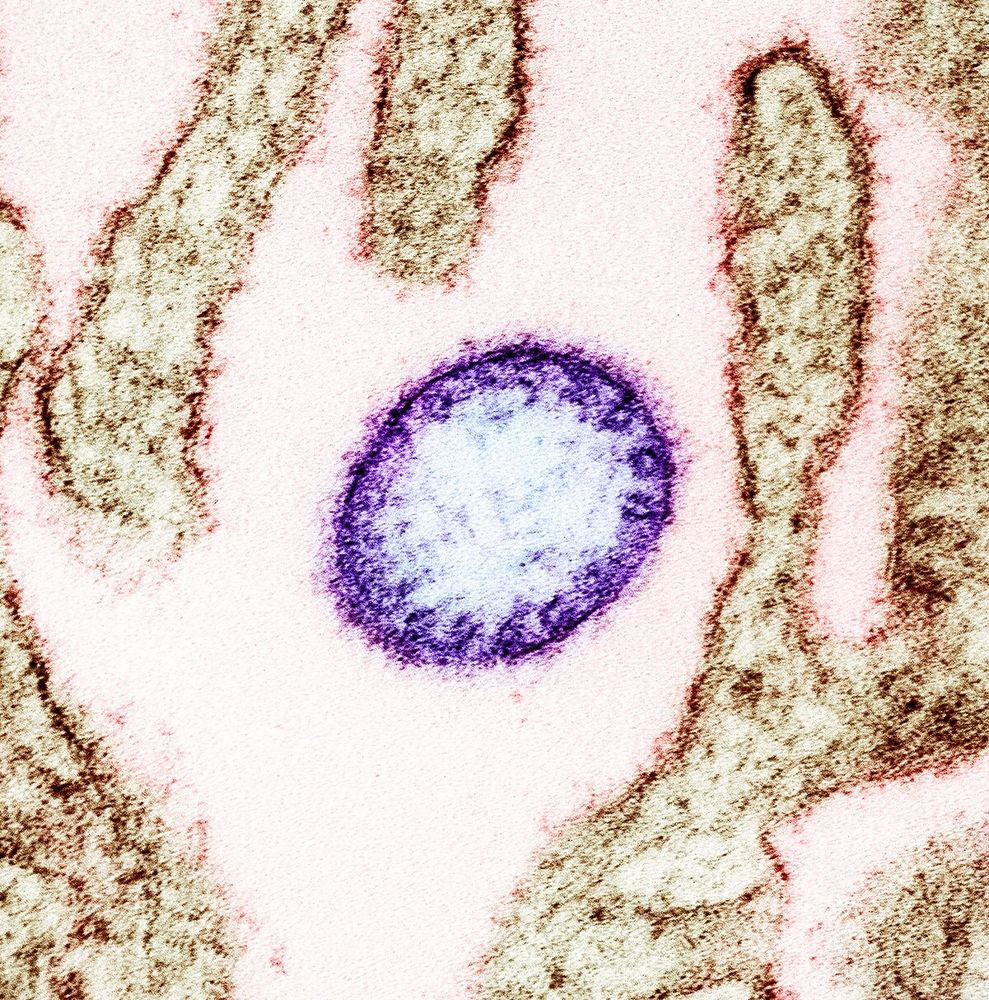 Image of Nipah virus (purple) in tissue. 

