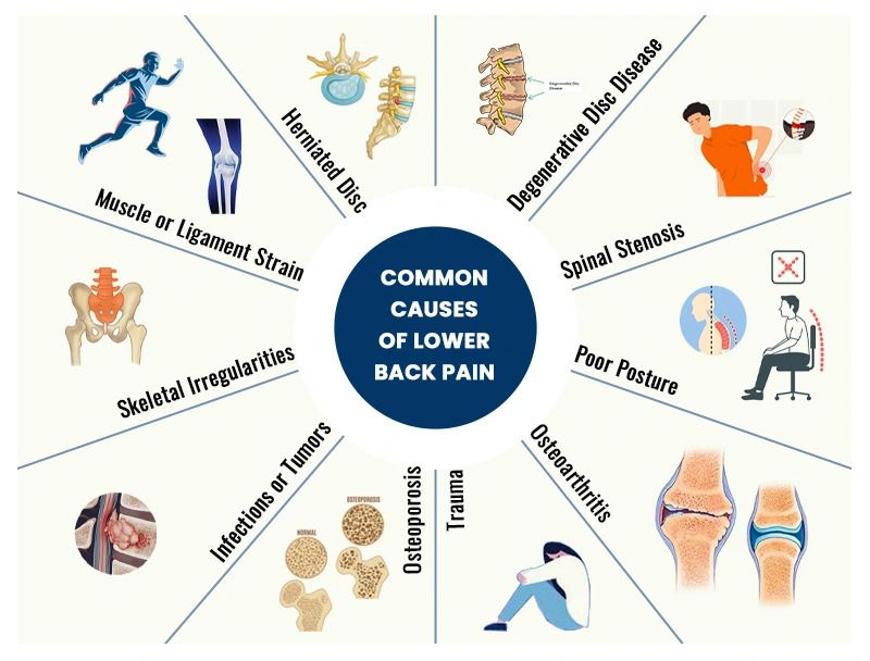 Causes of Lower Back Pain