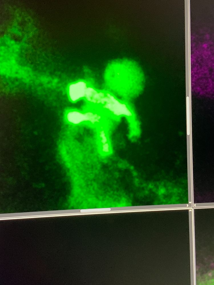 Image of a macrophage from a single Z plane that looks suspiciously human