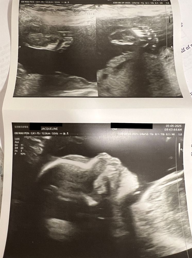 an ultrasound of the world's smallest space jam 2 enjoyer