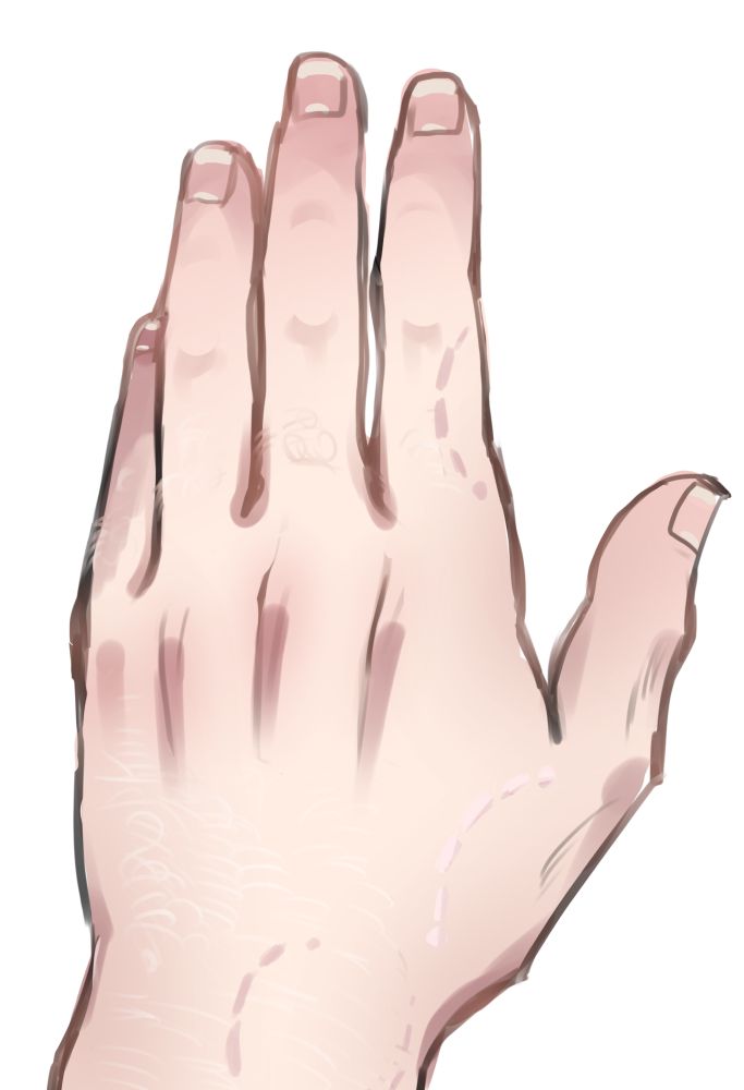 A man’s hand covered in human bite mark scars. He has very fine platinum blonde arm hair 
